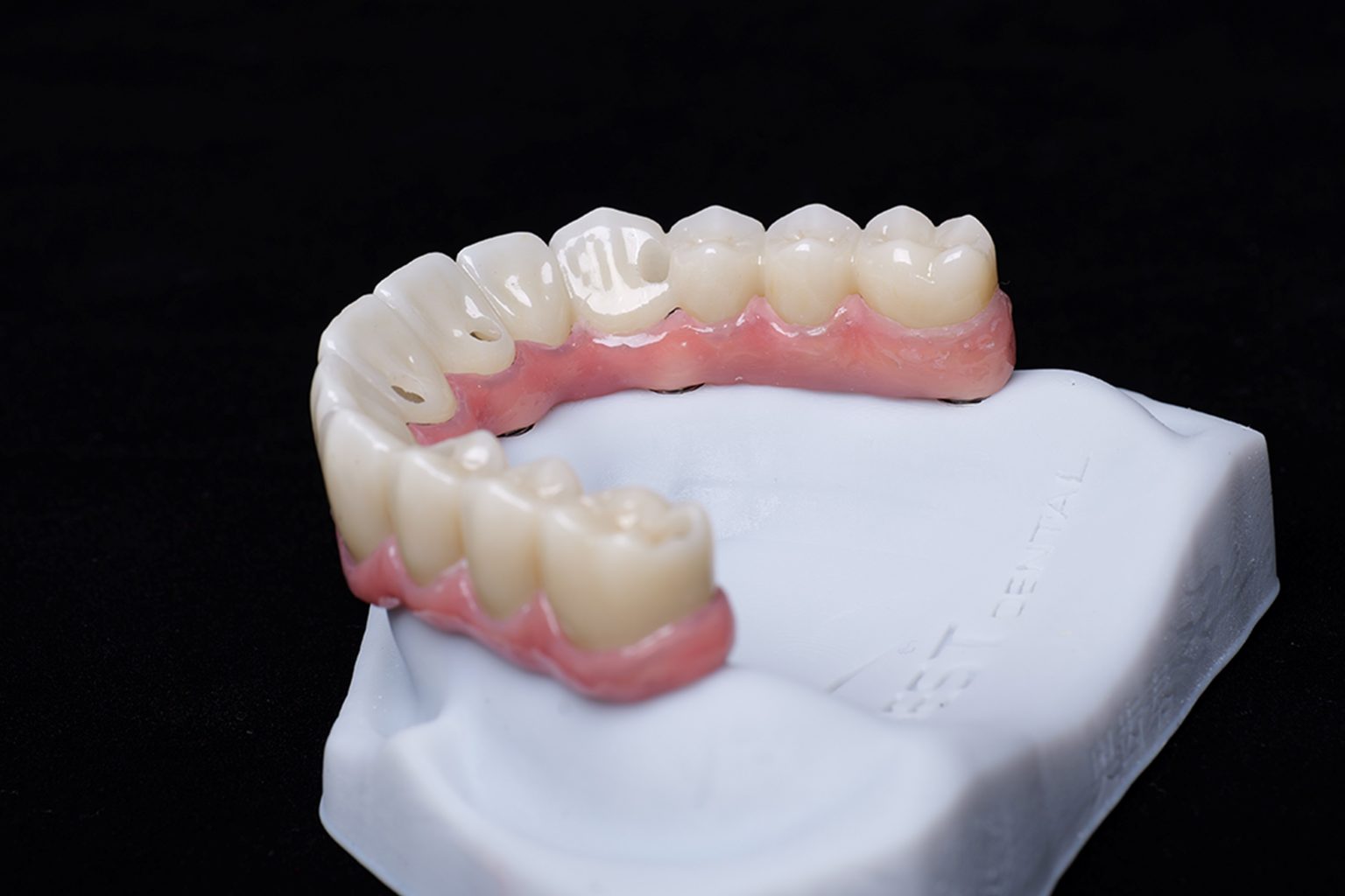 Full arch implant crown and bridge case