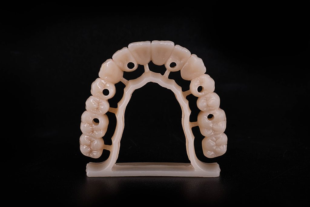 Multilayer zirconia implant restoration case
