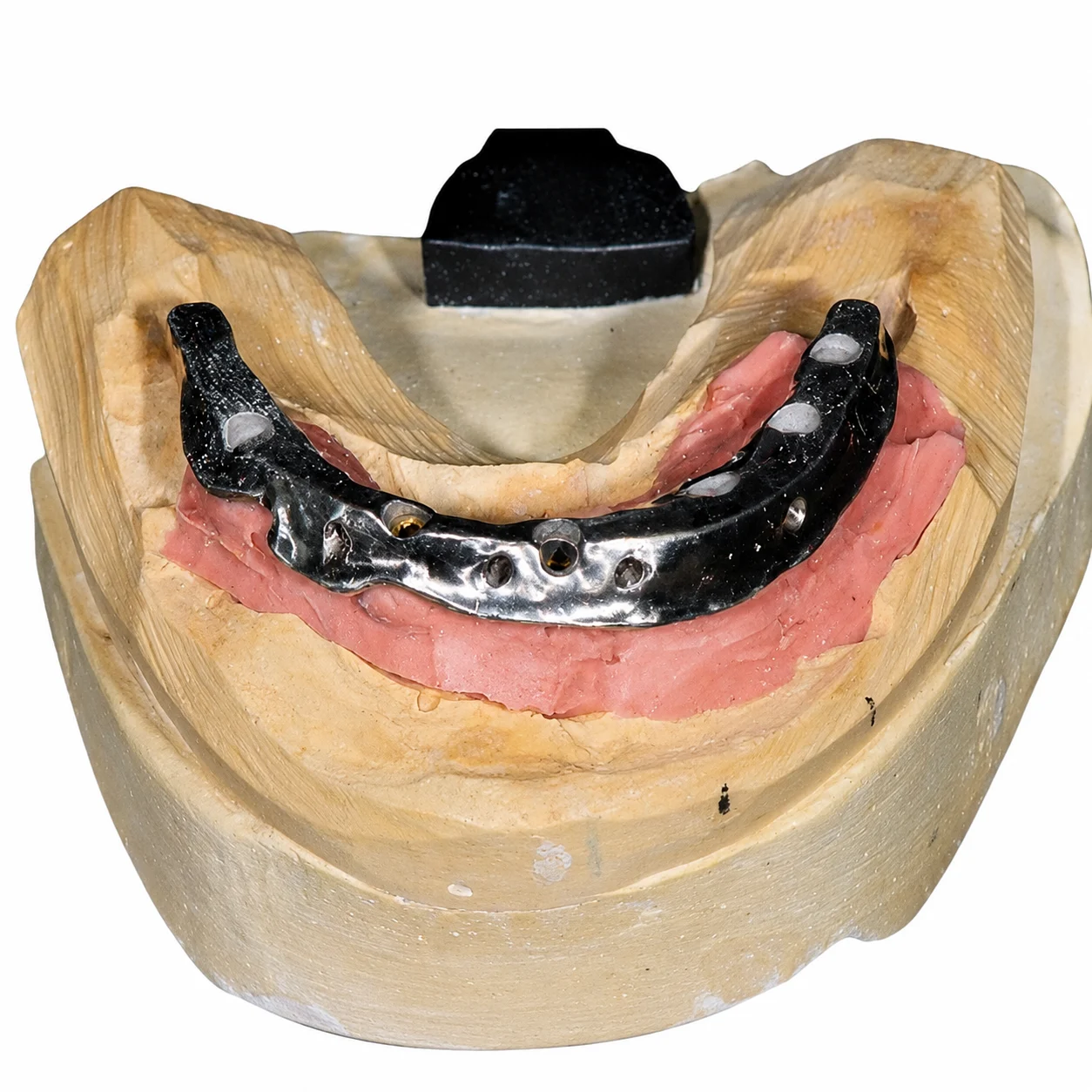 Finished hybrid implant full-arch restoration