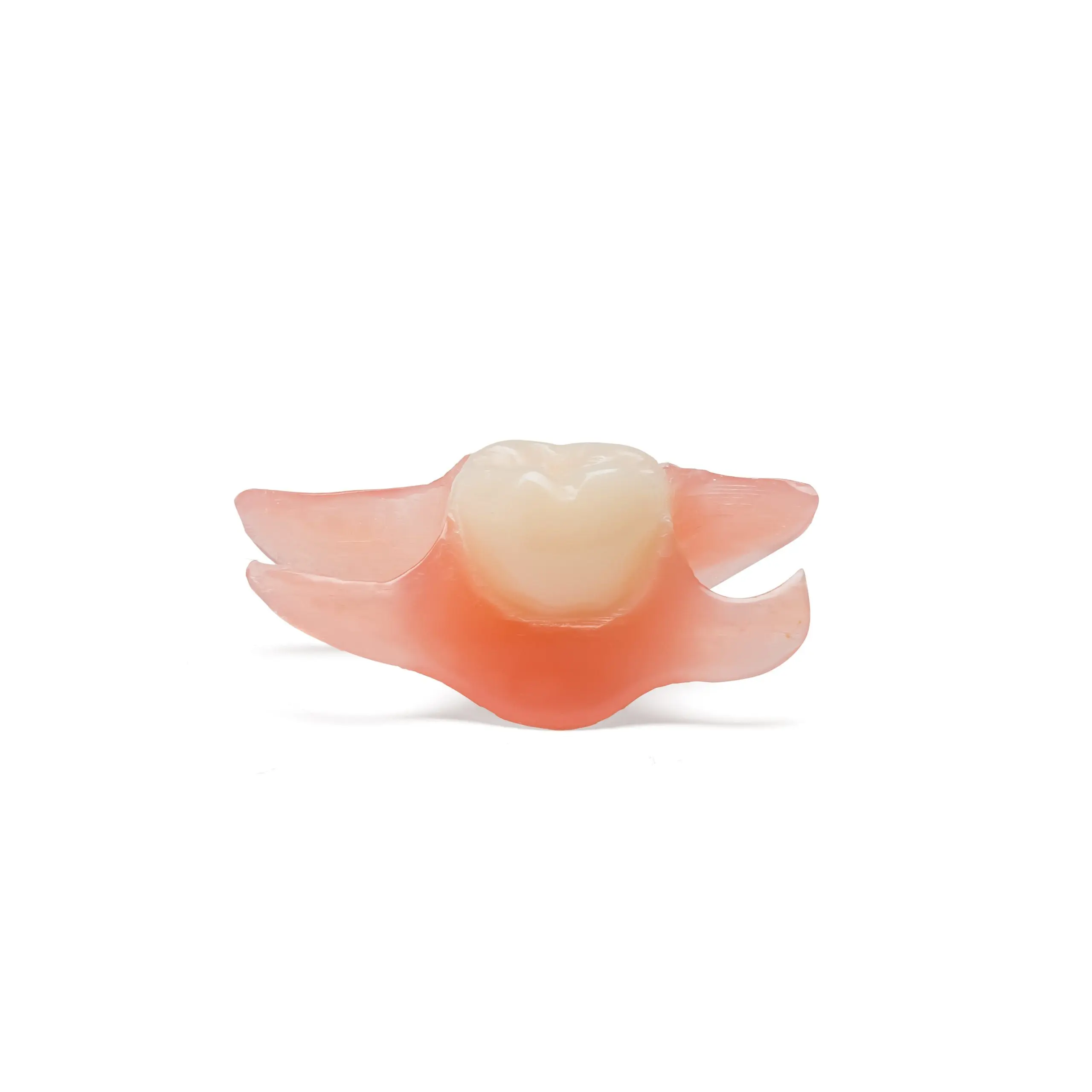 Finished Nesbit removable partial denture