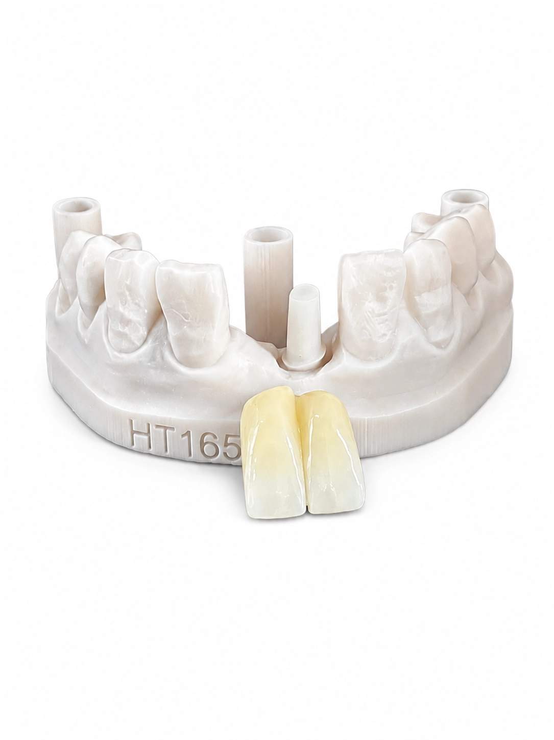 Finished screw-retained implant crown restoration